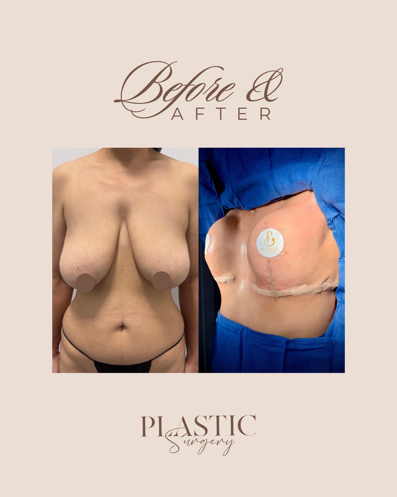 Resultado real de paciente de Dr. Felippe Sartorato en BET Aesthetics Center