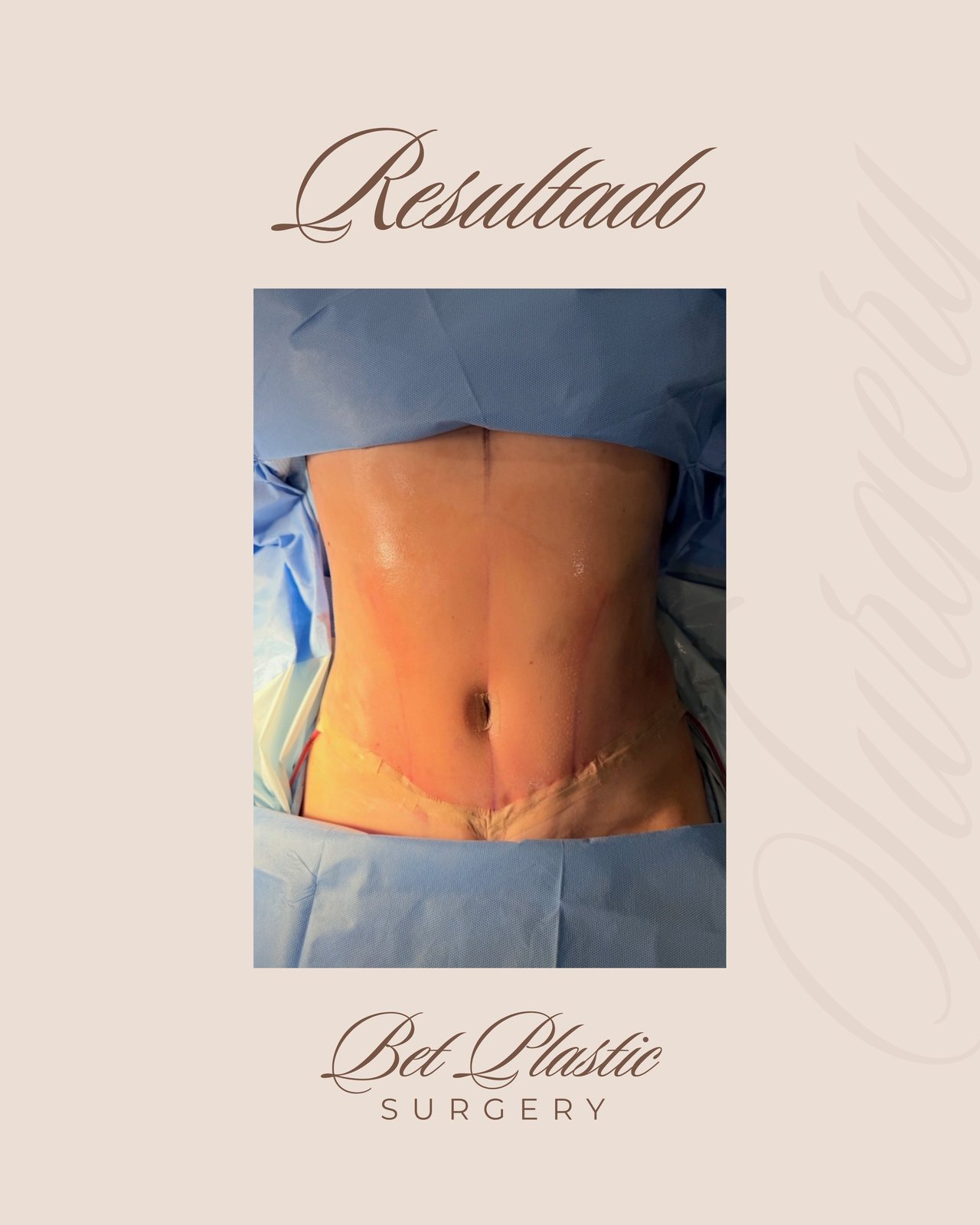 Resultado real de paciente de Dr. Felippe Sartorato en BET Aesthetics Center