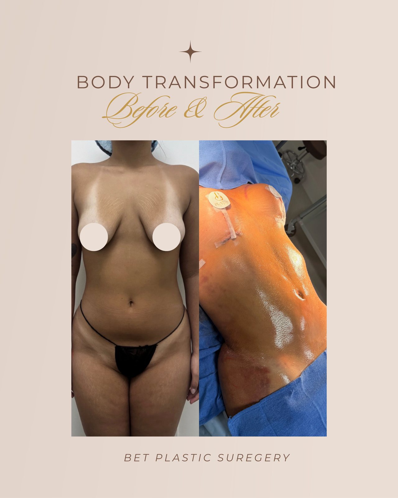 Resultado real de paciente de Dr. Felippe Sartorato en BET Aesthetics Center