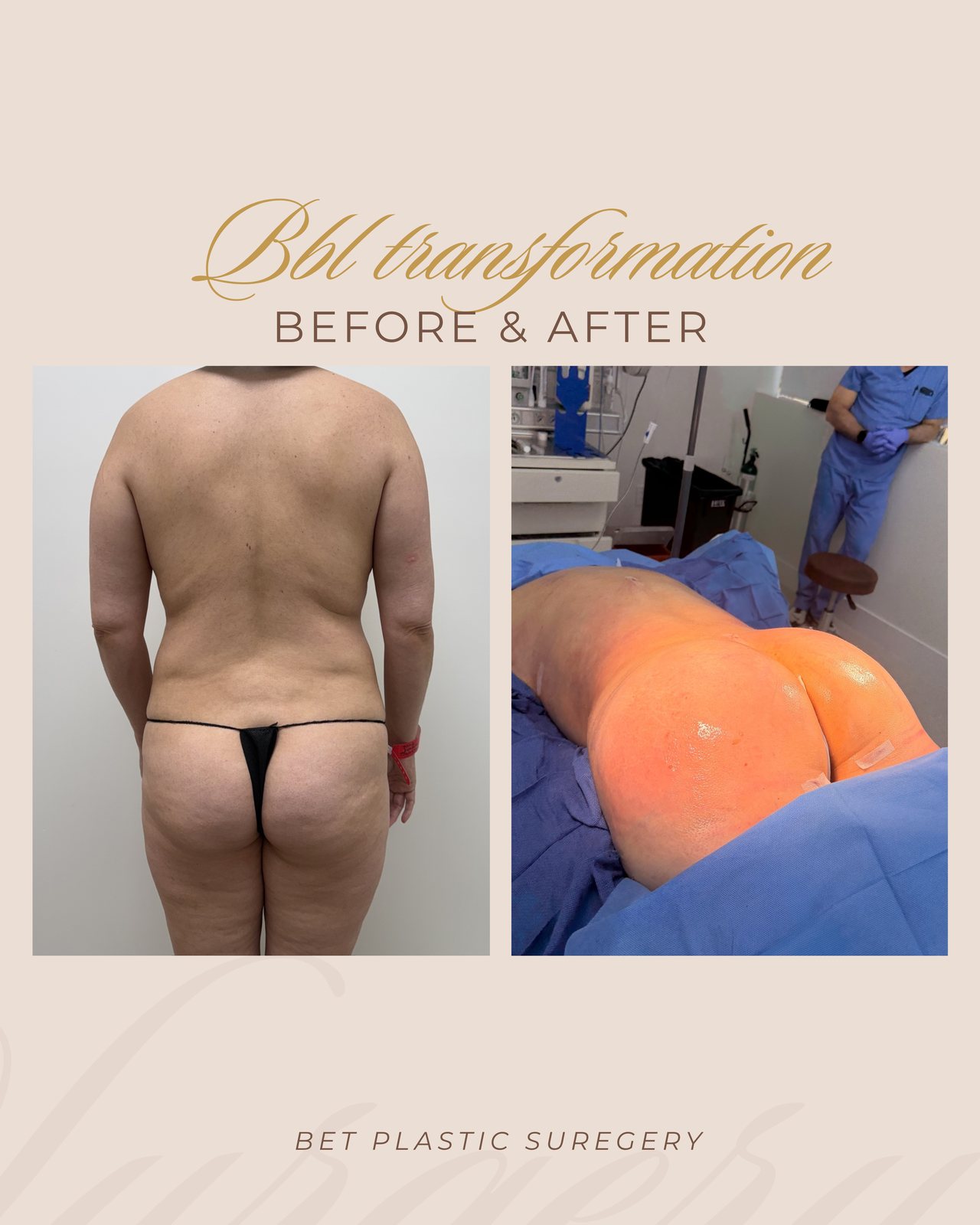 Resultado real de paciente de Dr. Felippe Sartorato en BET Aesthetics Center